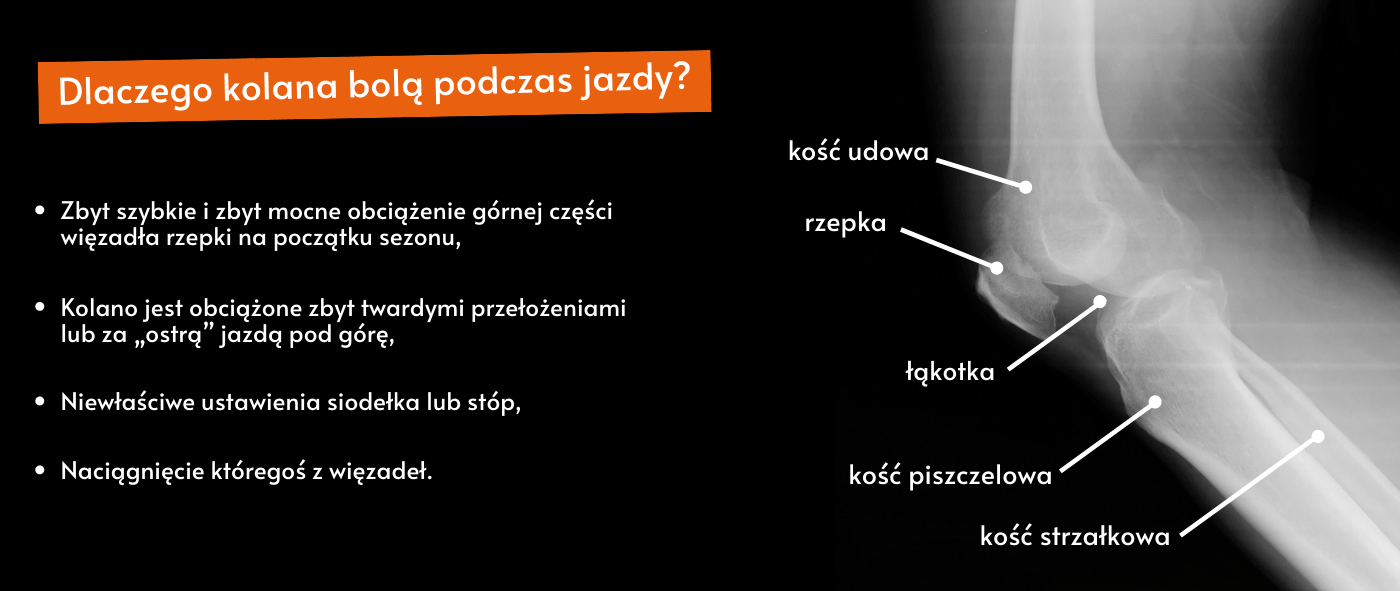 przyczyny bólu kolan podczas jazdy na rowerze